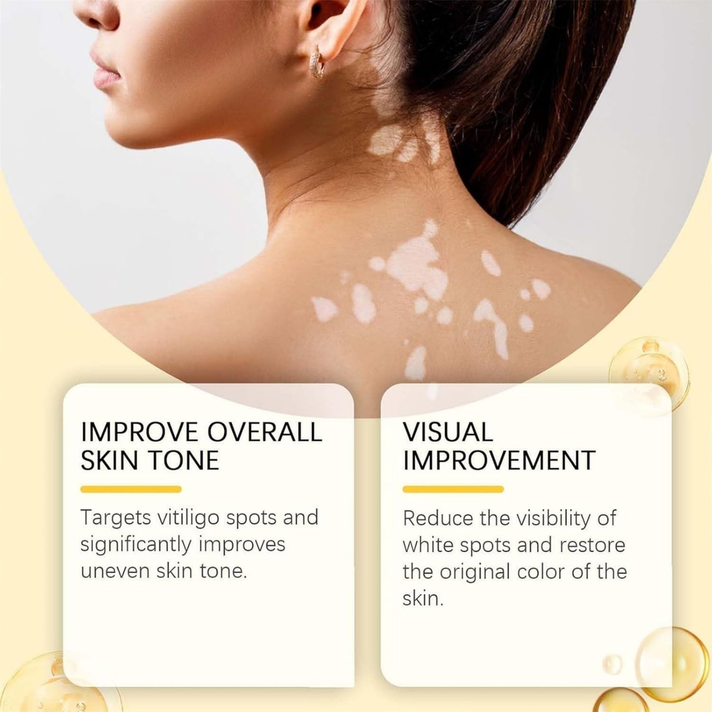 Vitigo Bee Venom Cream | Skin Repair, Hydration & Anti-Irritation