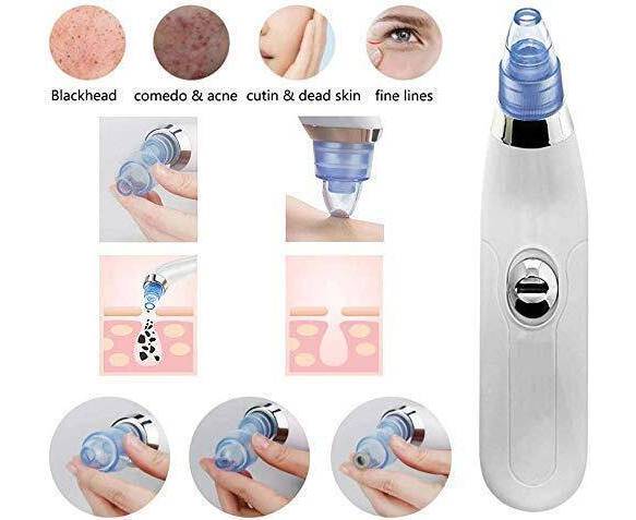3-in-1 Blackhead Removal Machine | Derma Suction Pore Cleaner & Acne Remover