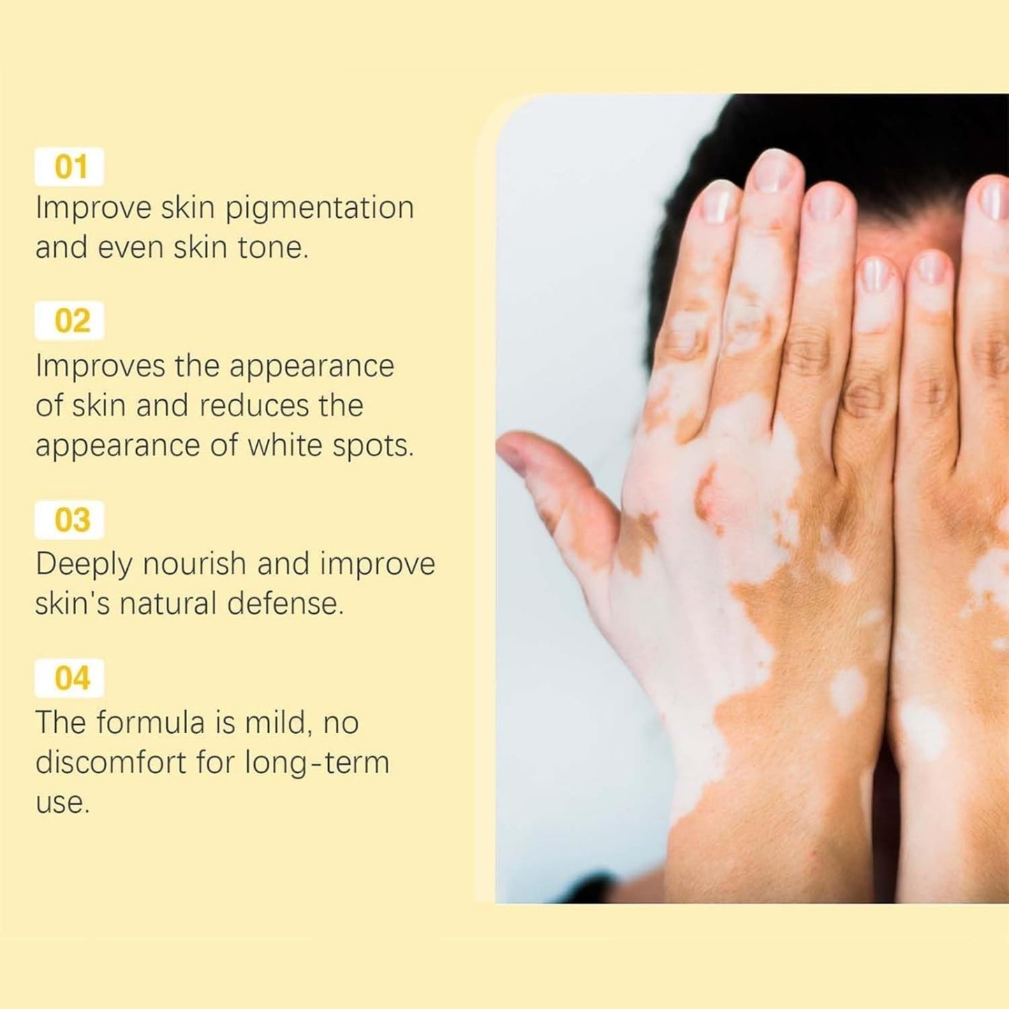 Vitigo Bee Venom Cream | Skin Repair, Hydration & Anti-Irritation